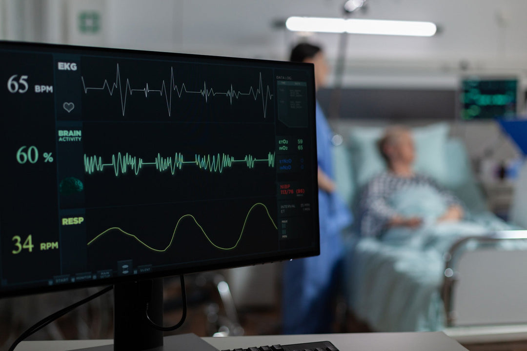 How to read your smartwatch ECG results and when to act